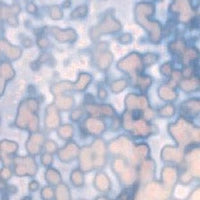 Blue-Gray White Ring Mottle